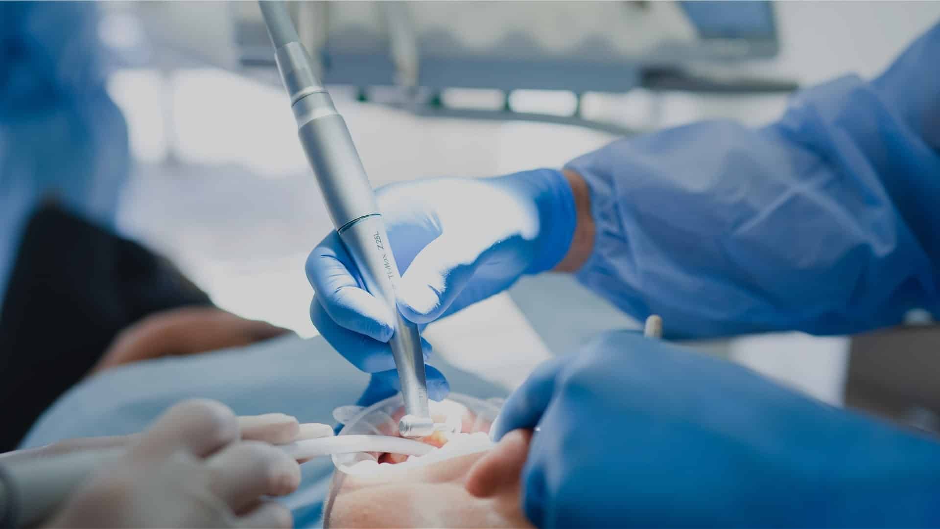 Perguntas frequentes sobre implantes dentários em Oeiras na Clínica Dr. Pedro Coelho