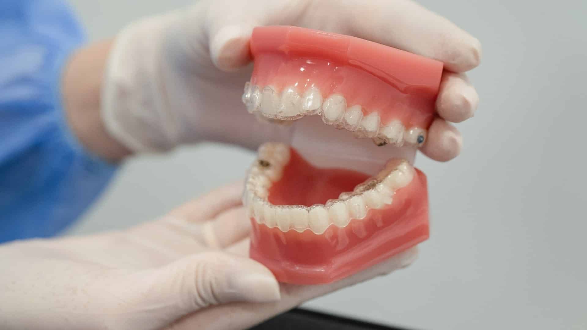 Ortodontia e Sistemas Invisalign em Oeiras
