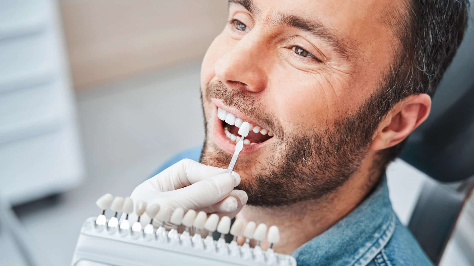 Estética Dentária, Facetas e Branqueamento