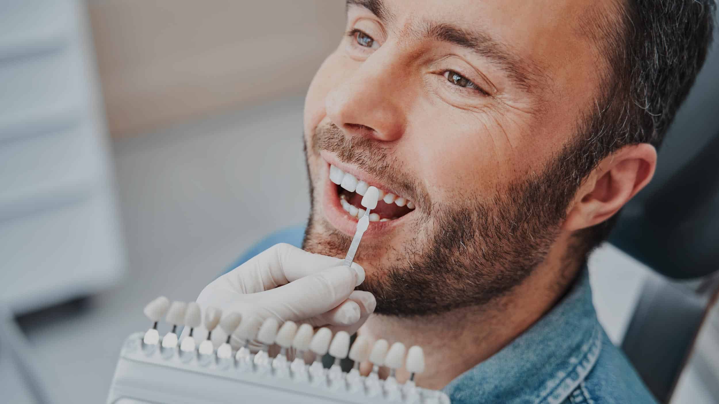 branqueamento dentário profissional