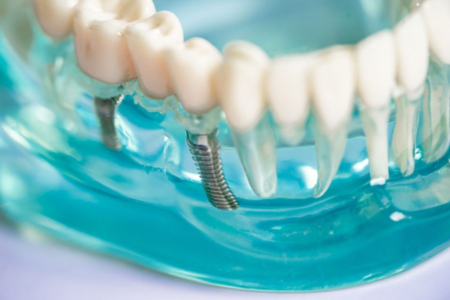 Que Garantia tem um tratamento dentário?