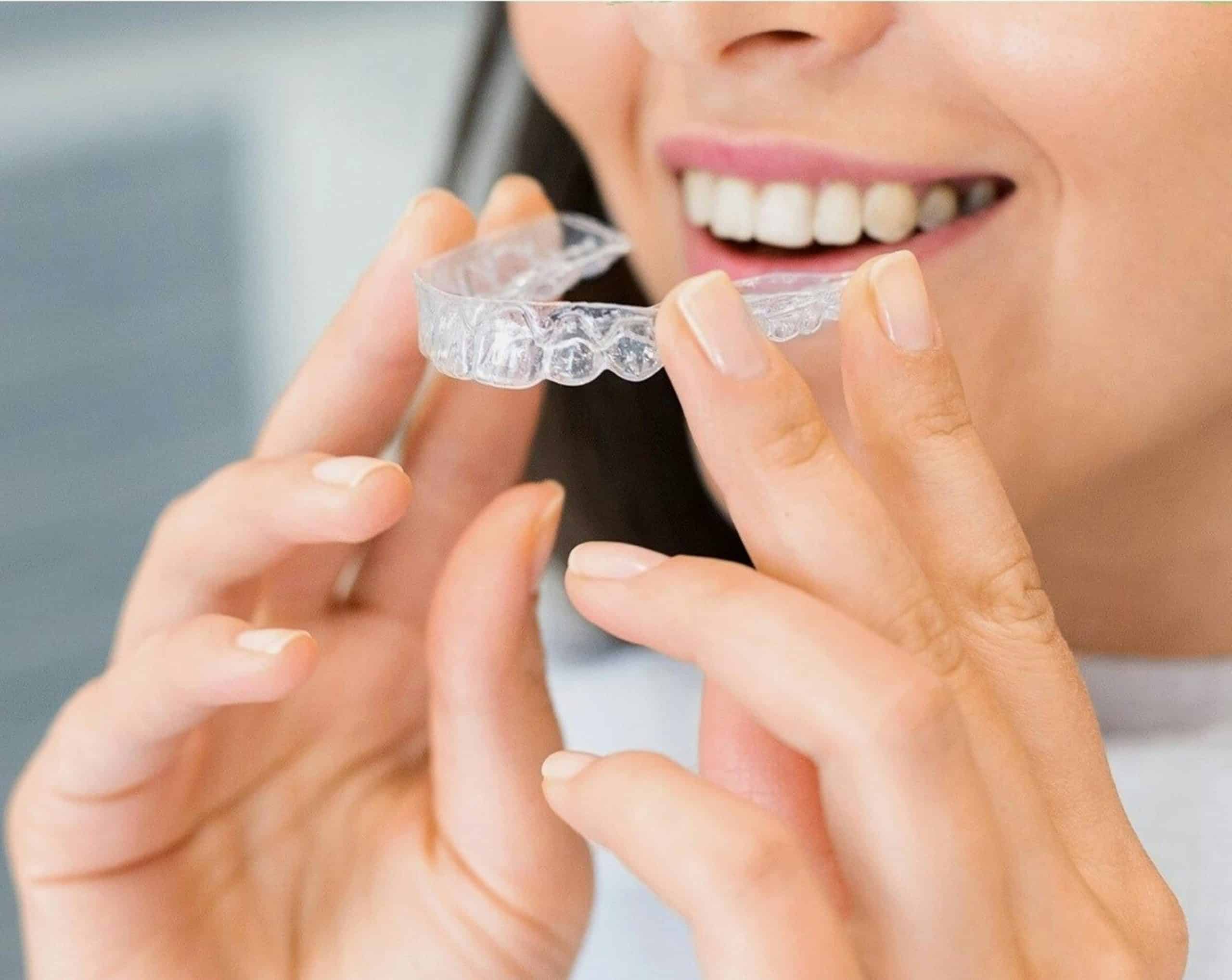 Alinhadores transparentes Invisalign utilizados para alinhar os dentes de forma discreta